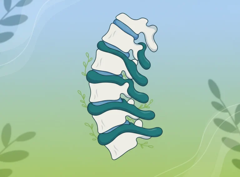 Osteófitos (bico de papagaio) surgem de desgaste na coluna. Descubra causas, prevenção e como a quiropraxia pode melhorar mobilidade, com informações científicas.